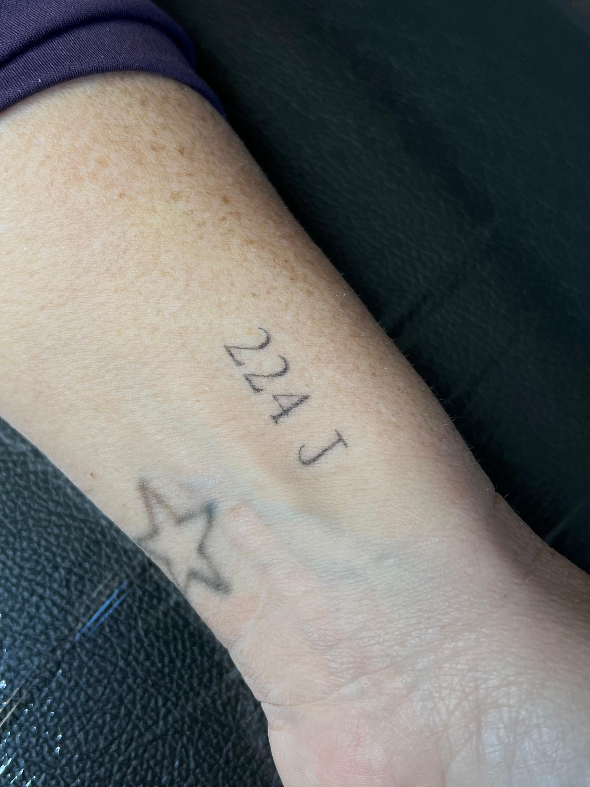 Fineline tattoos, genezen