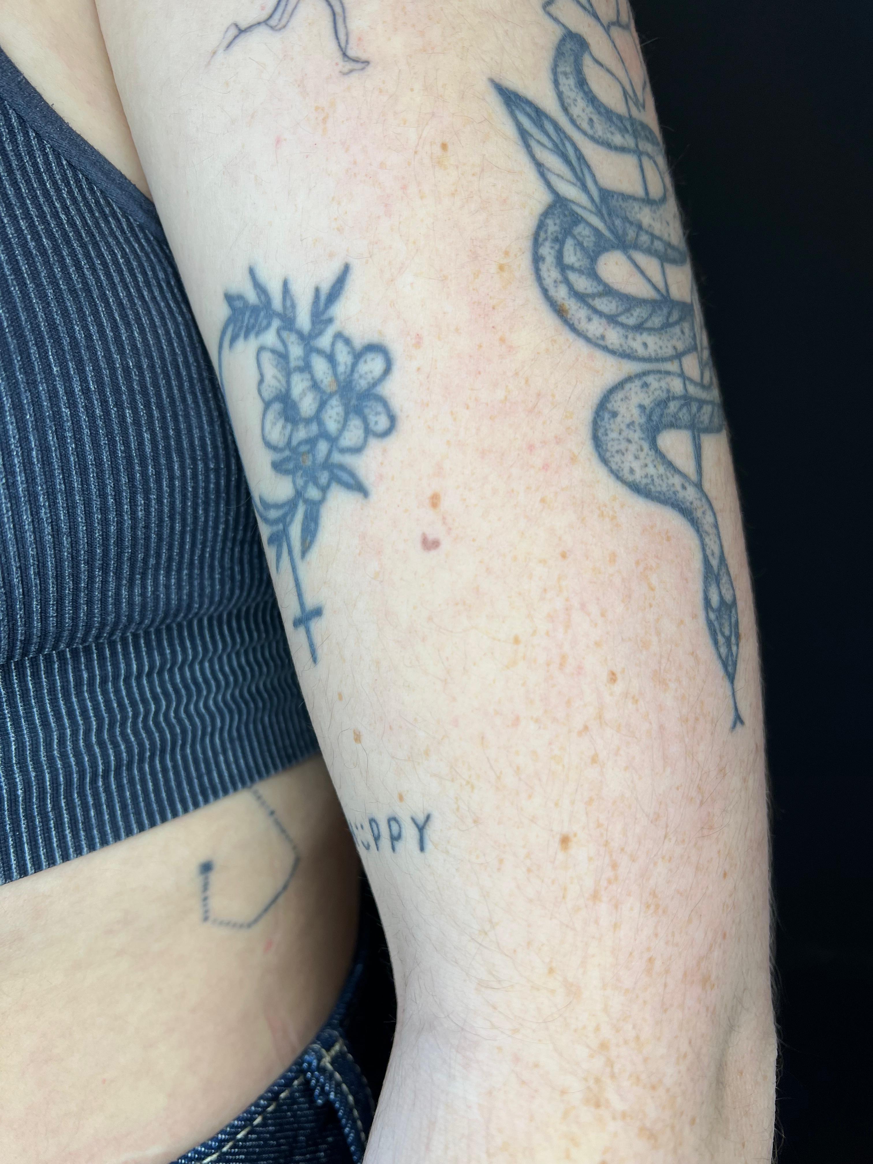 Freckle hearts, genezen