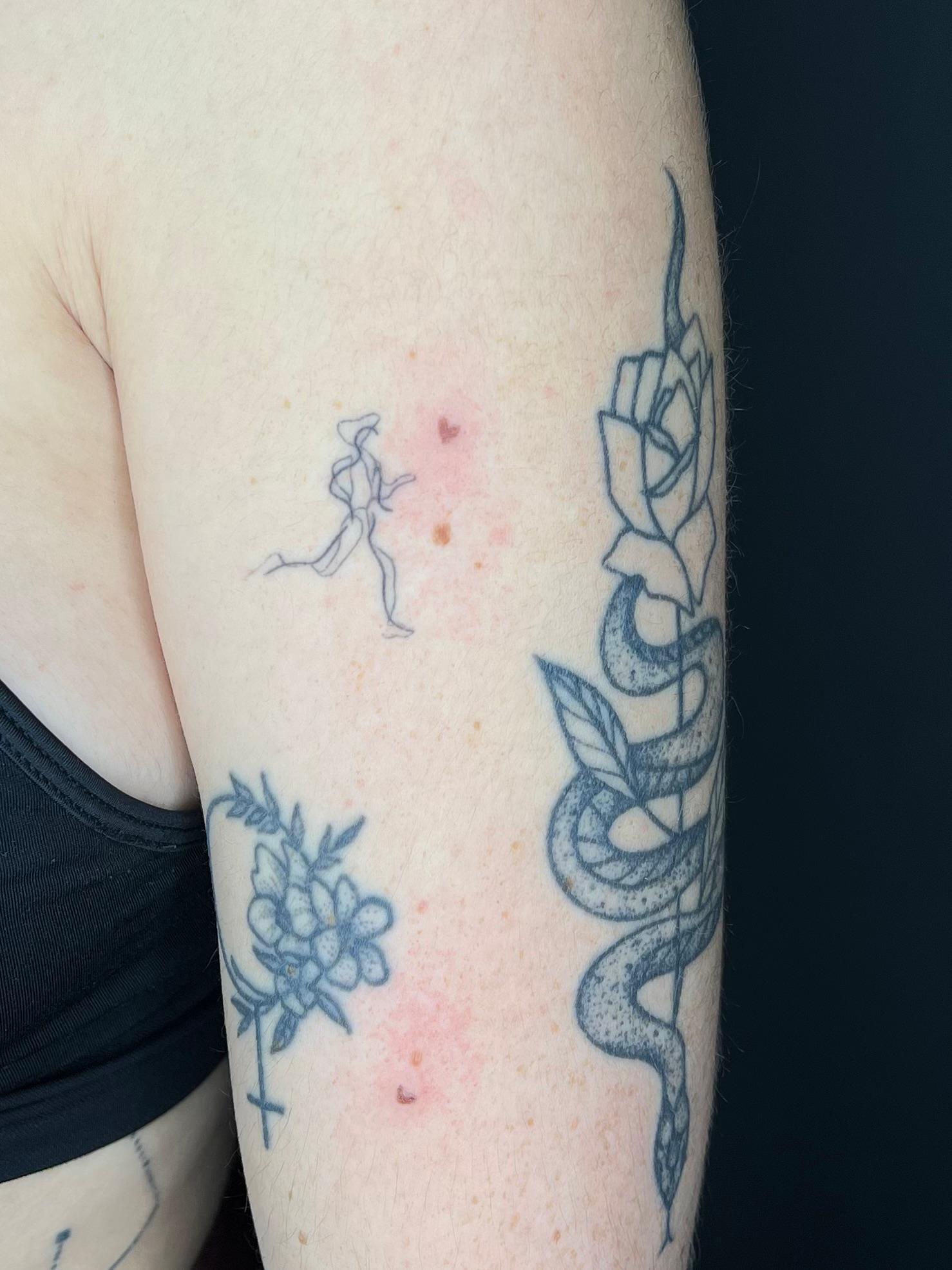 Freckle hearts, direct na de behandeling