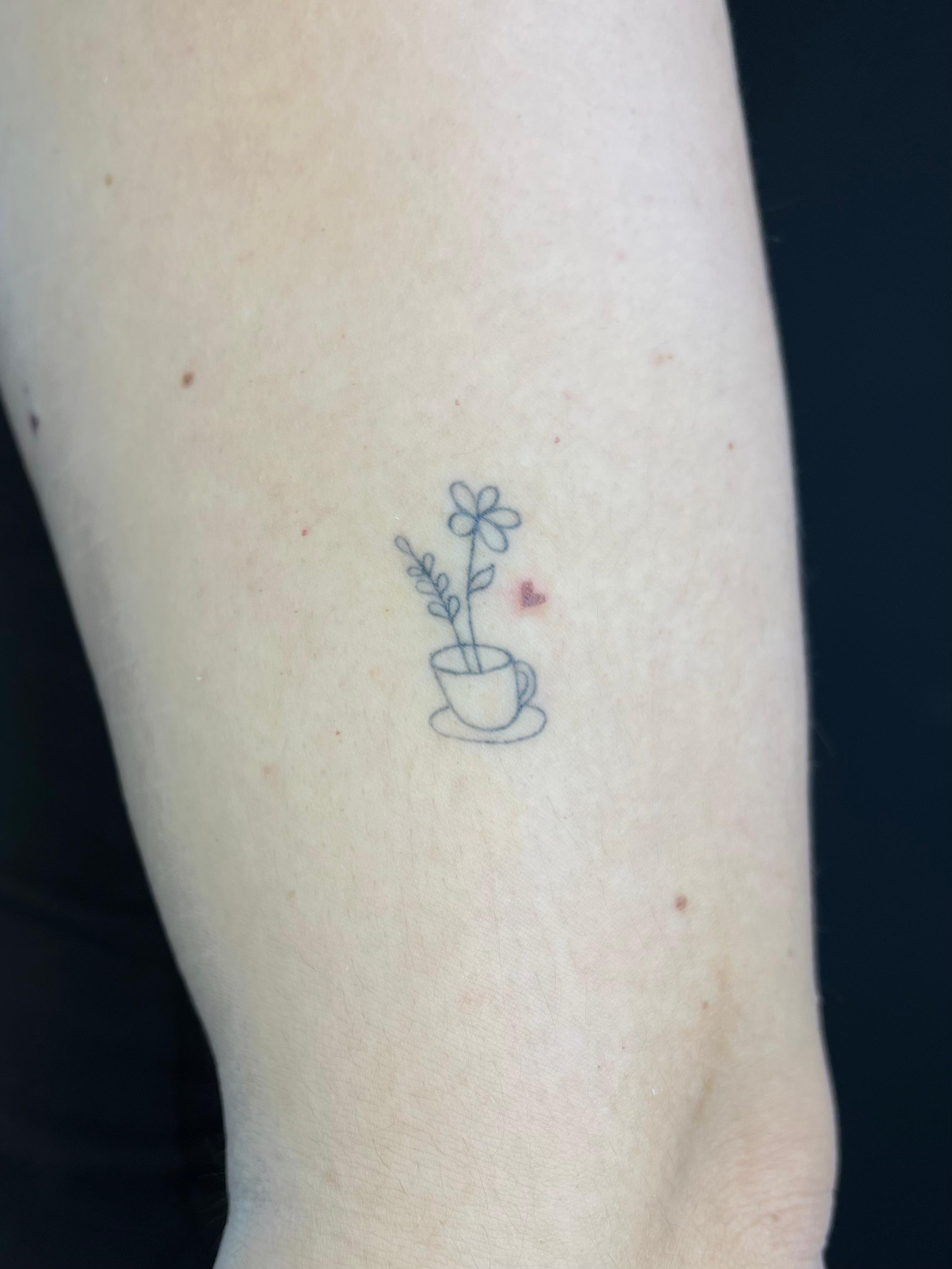 Freckle hearts, direct na de behandeling