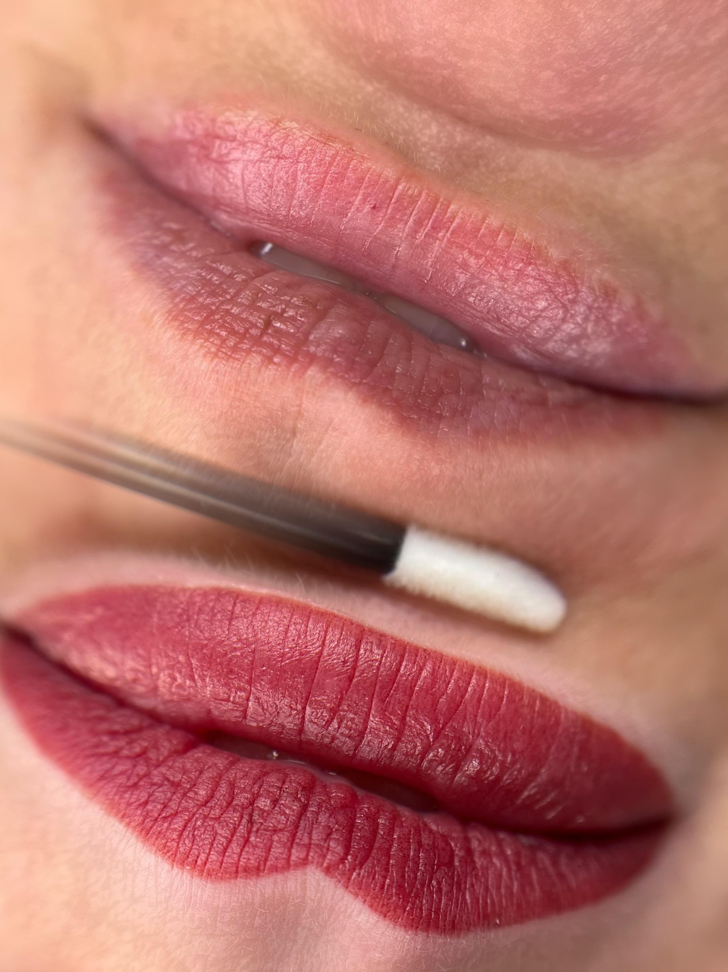 Lippigmentatie, voor & direct na de behandeling