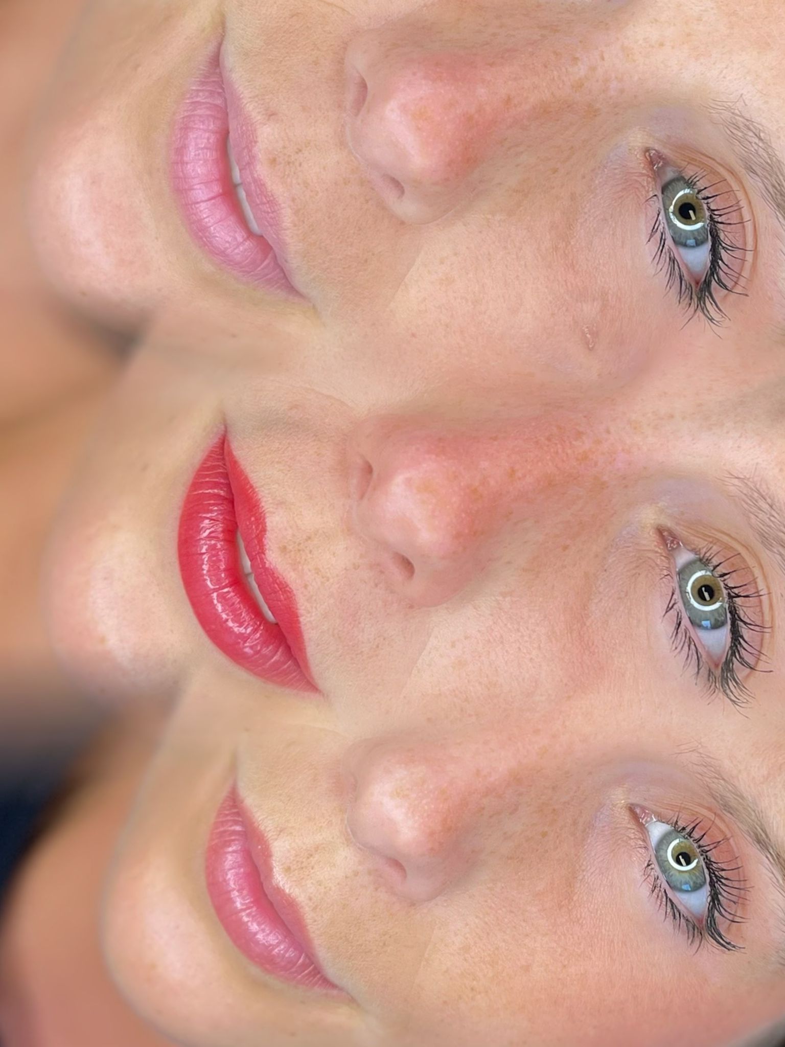 Lippigmentatie, voor, direct na de behandeling & genezen