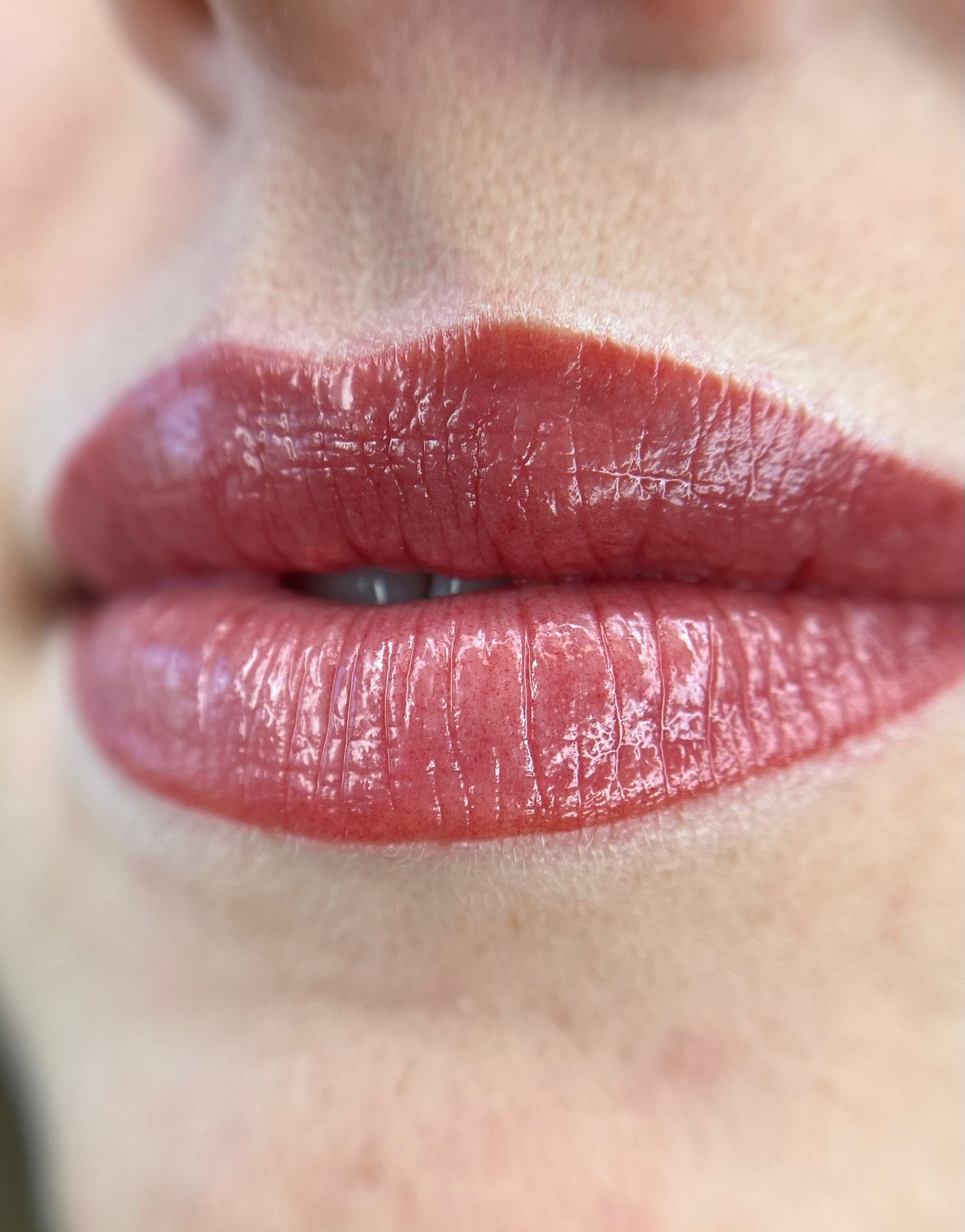 Lippigmentatie direct na de behandeling