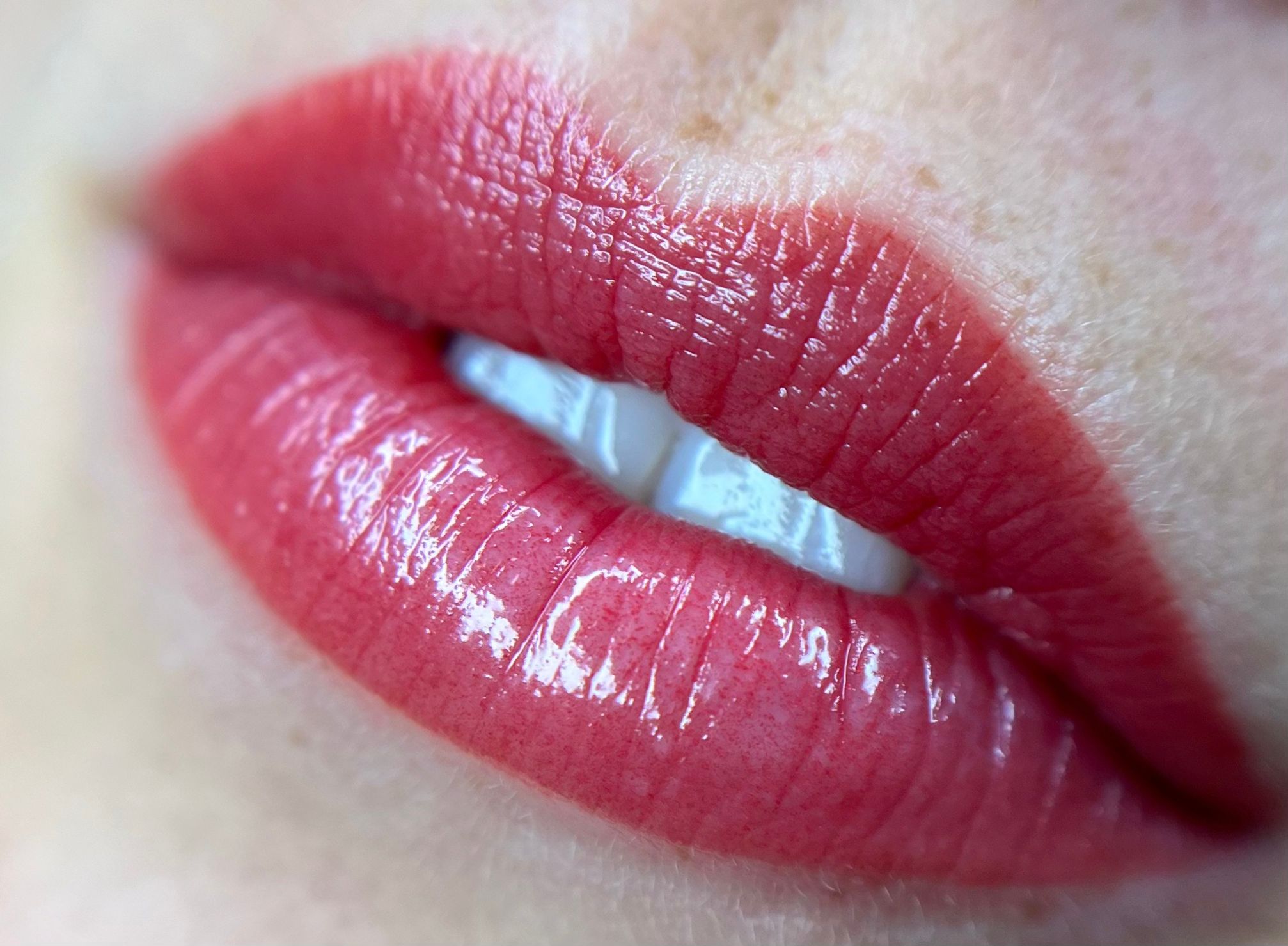 Lippigmentatie direct na de behandeling