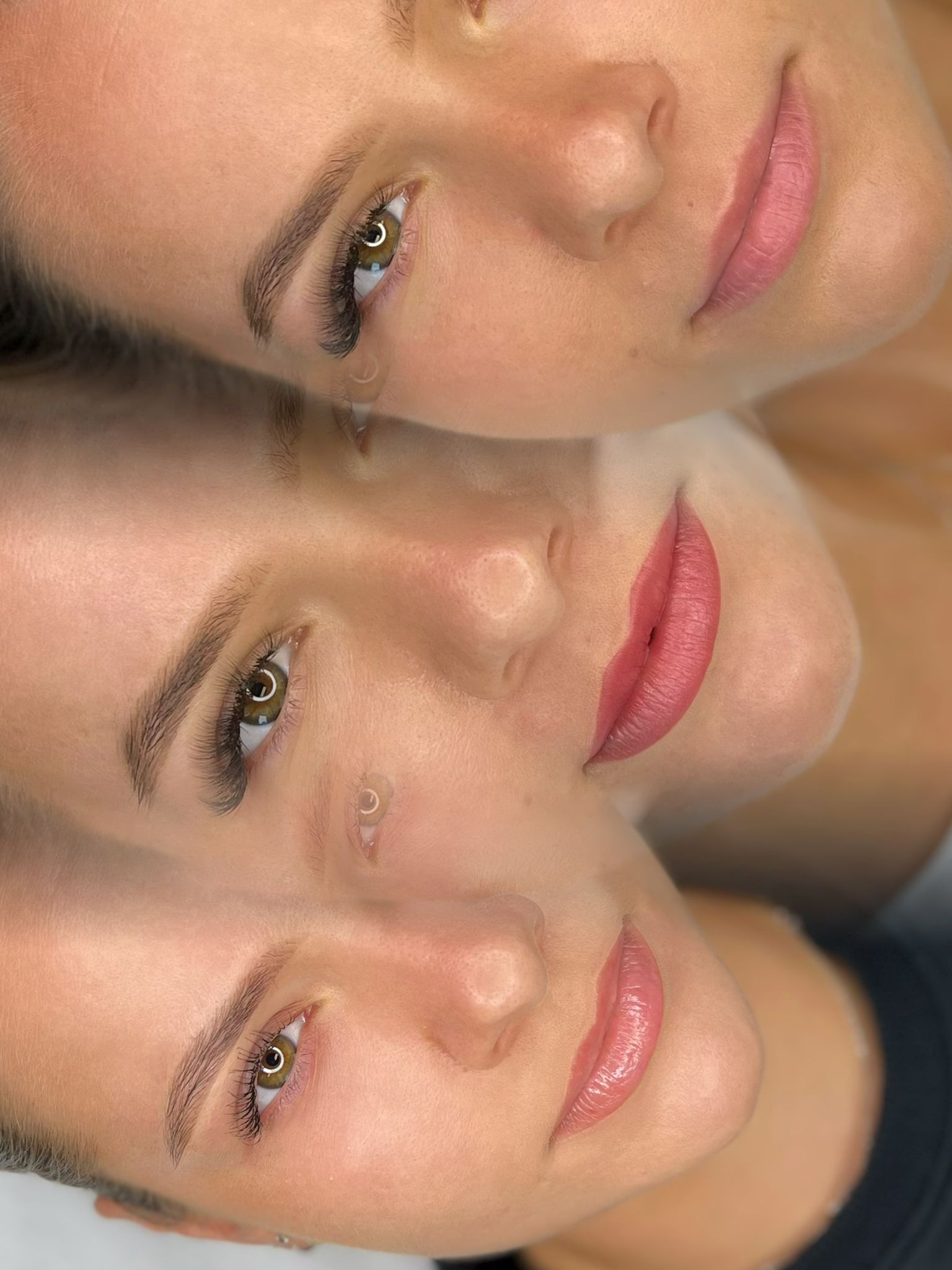 Lippigmentatie, voor, direct na de behandeling & genezen