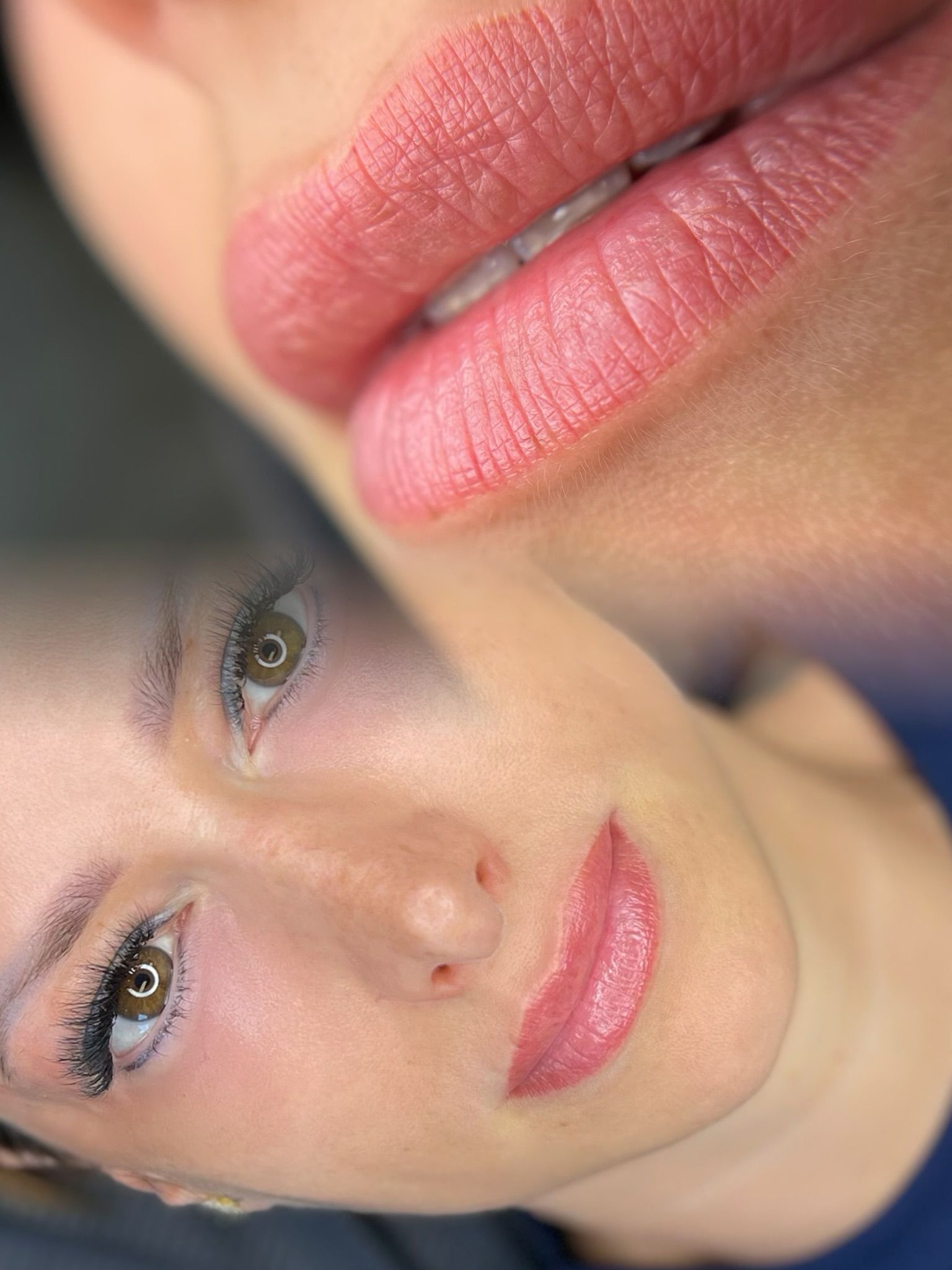 Lippigmentatie genezen