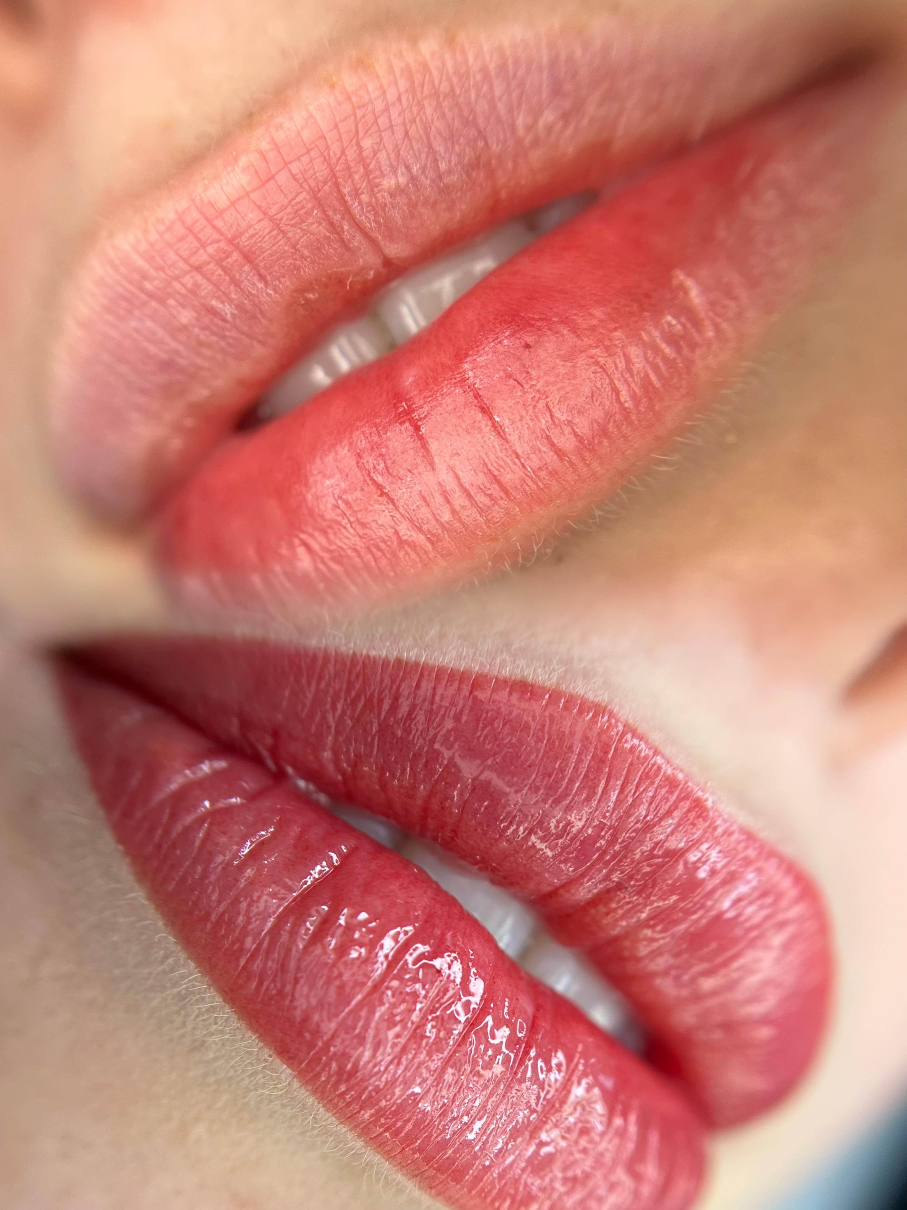 Lippigmentatie, voor & direct na de behandeling