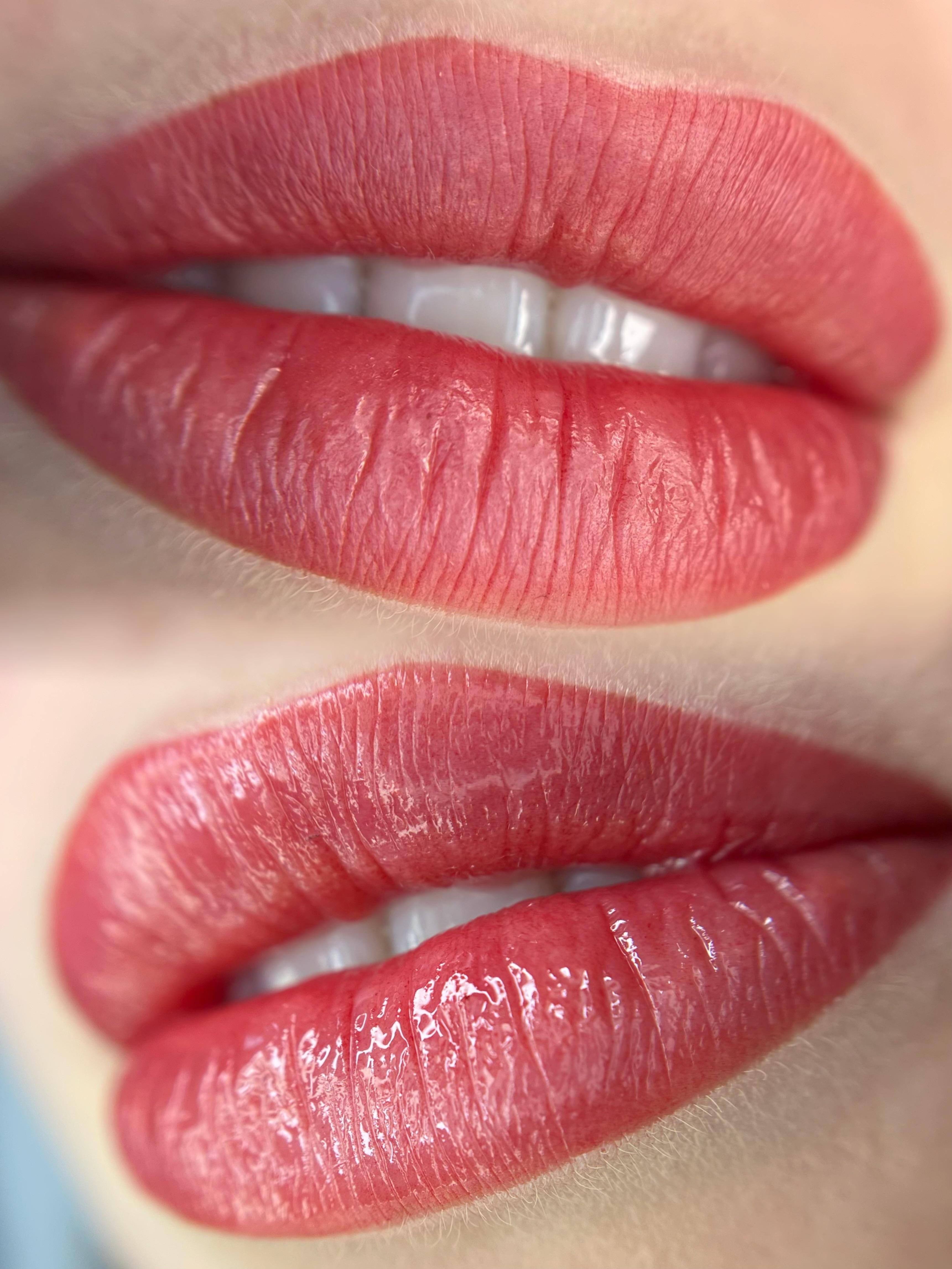 Lippigmentatie direct na de behandeling