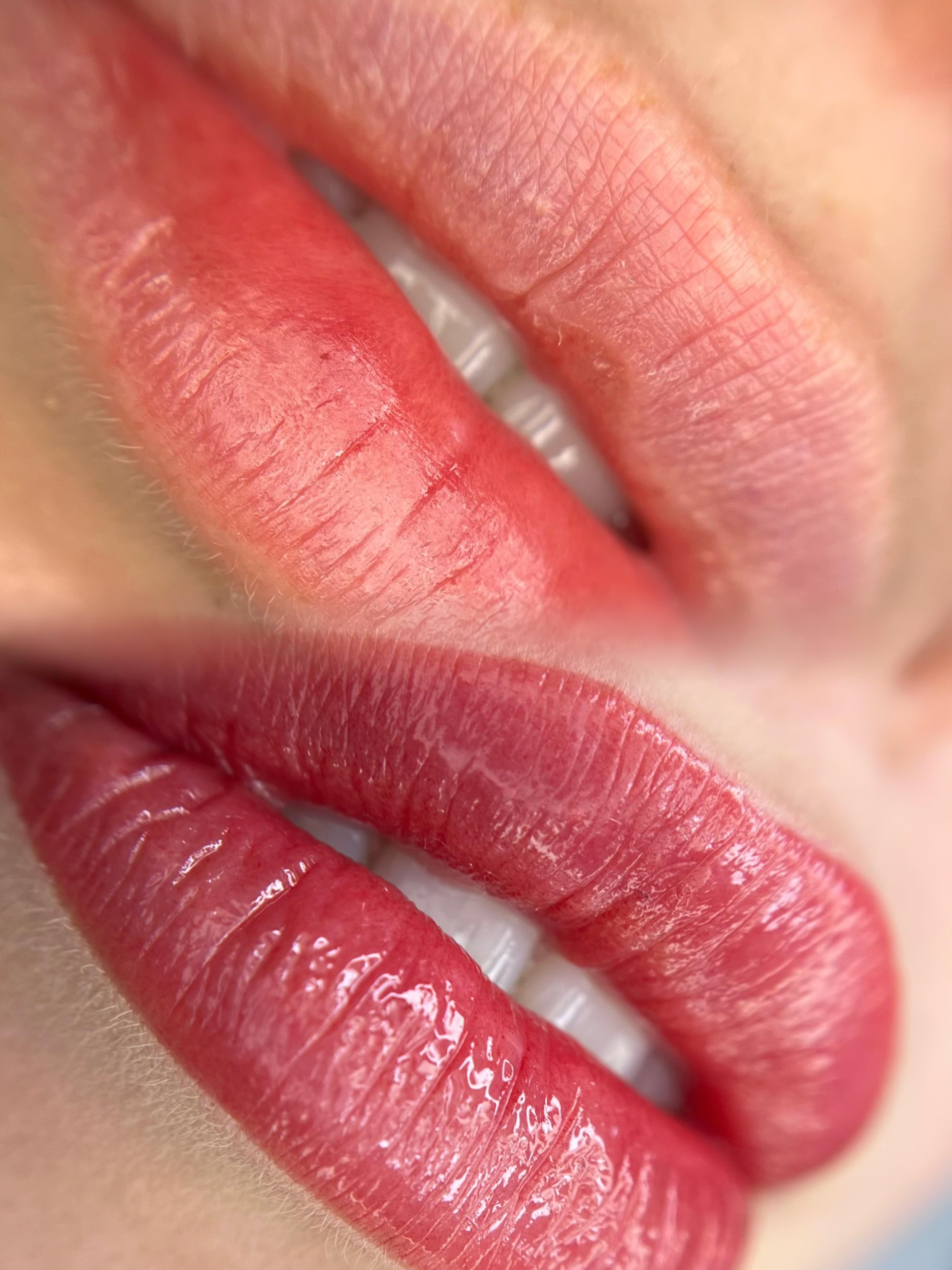 Lippigmentatie, voor & direct na de behandeling