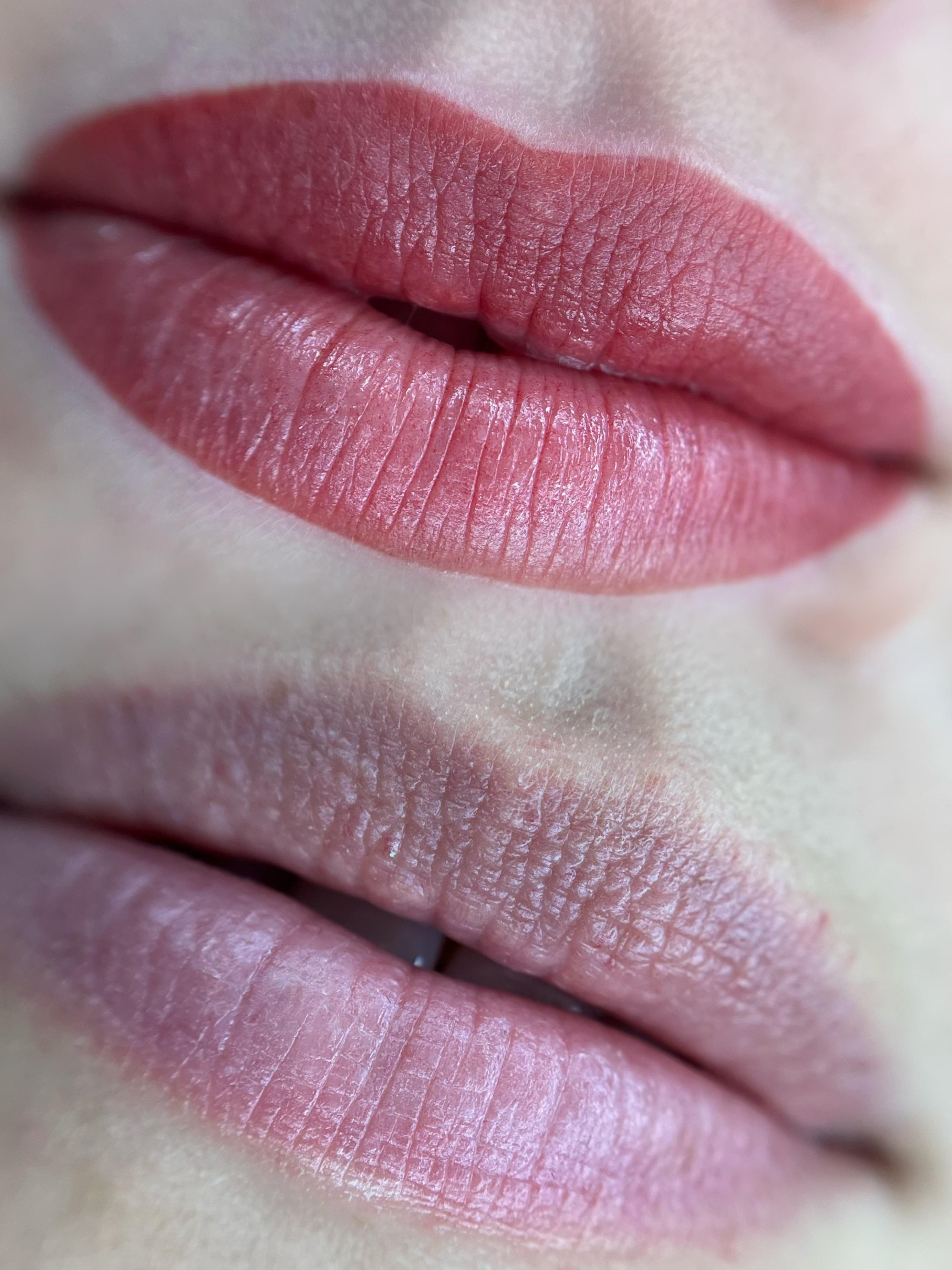 Lippigmentatie, voor & direct na de behandeling