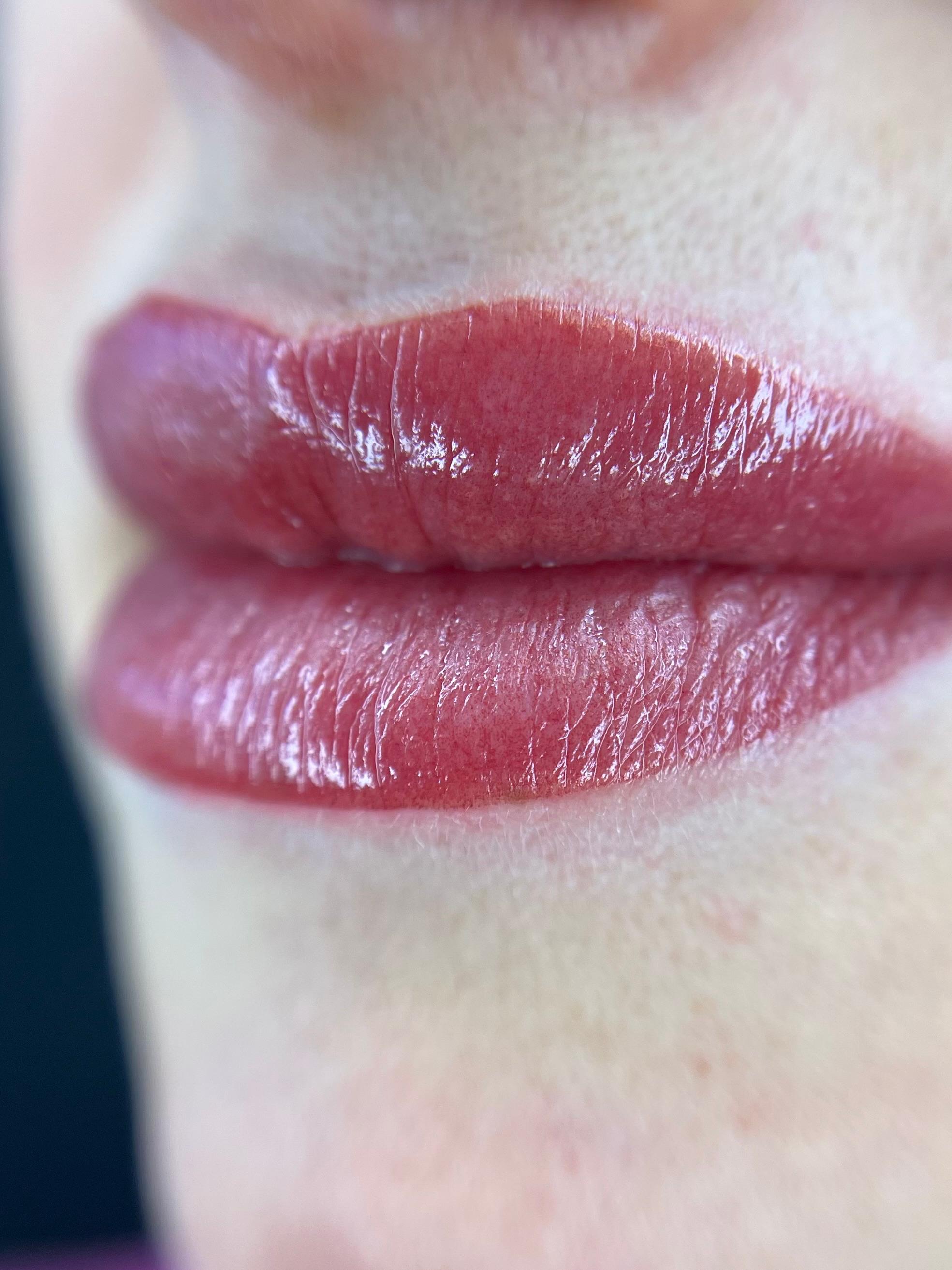 Lippigmentatie direct na de behandeling